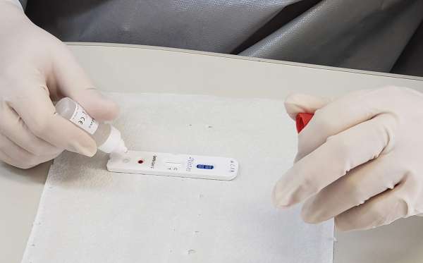 Secretaria de Saúde confirma 2 casos da variante delta da Covid-19 em Eusébio