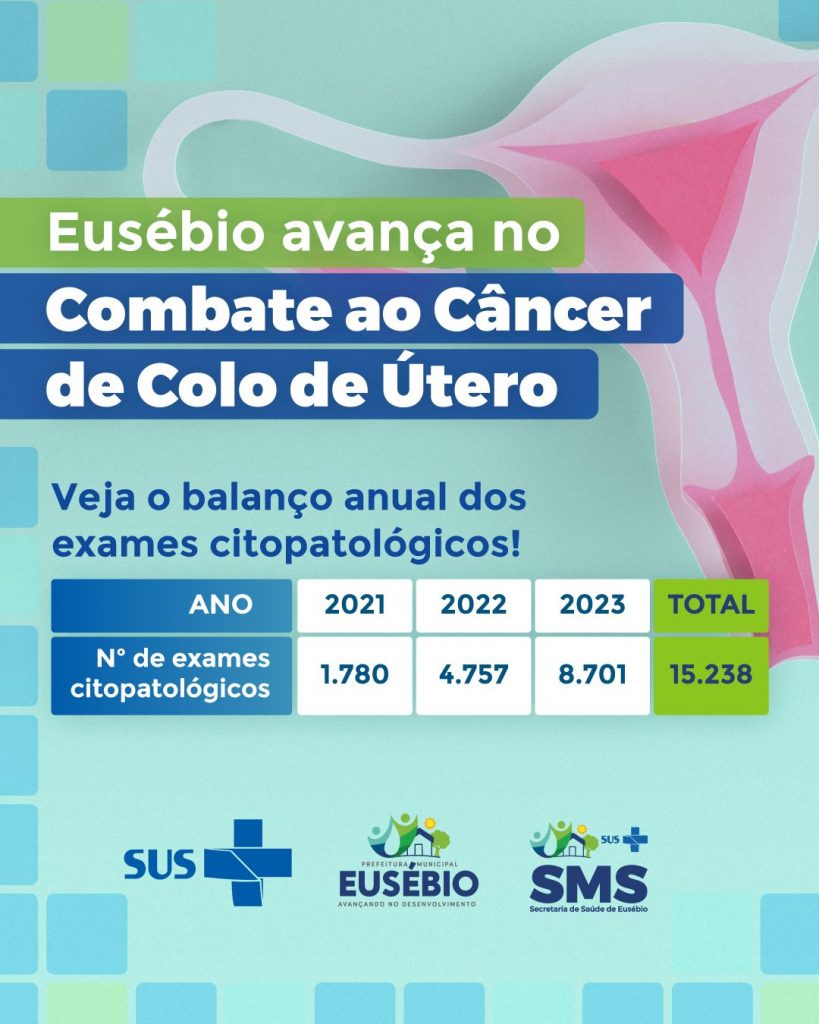 Eusébio atinge marca histórica de exames de prevenção ao câncer de colo de útero e zera fila de espera